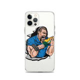Alternative Hero - Biting Knee Caps Clear Case for iPhone®