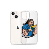 Alternative Hero - Biting Knee Caps Clear Case for iPhone®