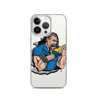 Alternative Hero - Biting Knee Caps Clear Case for iPhone®